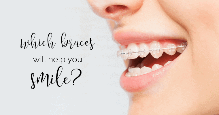 choose the right braces