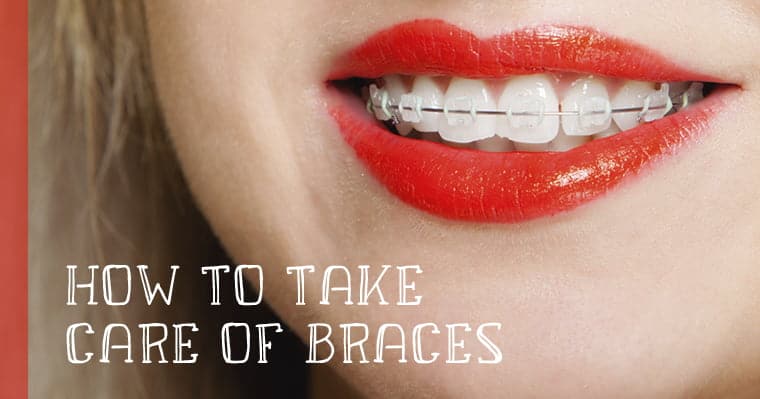 take care of braces oral hygiene