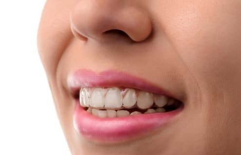 utica dental tulsa ok cosmetic dentistry invisalign