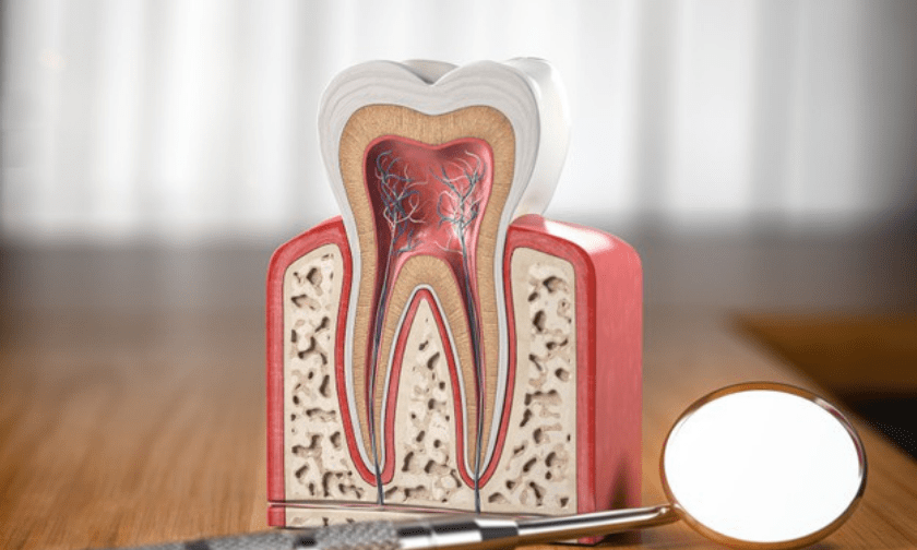 Pros & Cons of Root Canal Therapy
