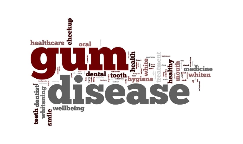 Gum disease word cloud graphic