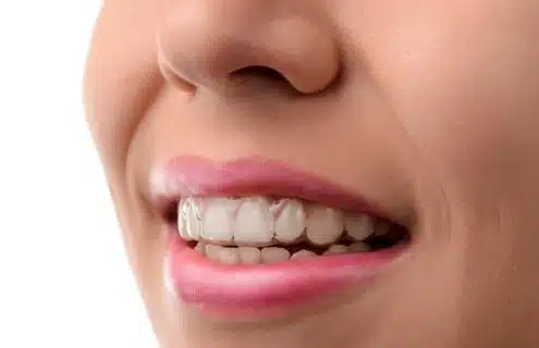 utica-dental-tulsa-ok-cosmetic-dentistry-invisalign A smile
