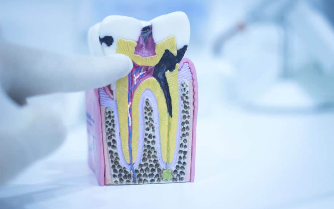 Illustration of root canal cross section