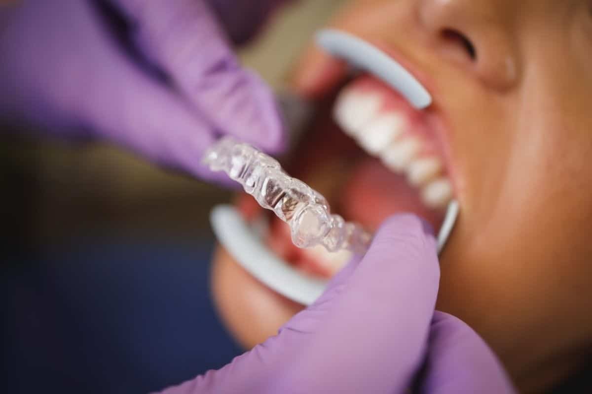 Invisalign Problems 8 Common Problems With Invisalign