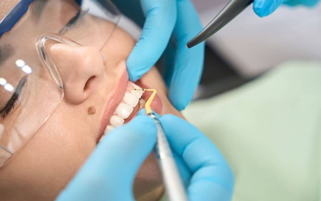 Close up of dental scaling procedure