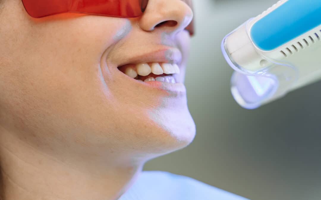 Veneers, Bonding, or Whitening? How to Choose the Right Smile Upgrade