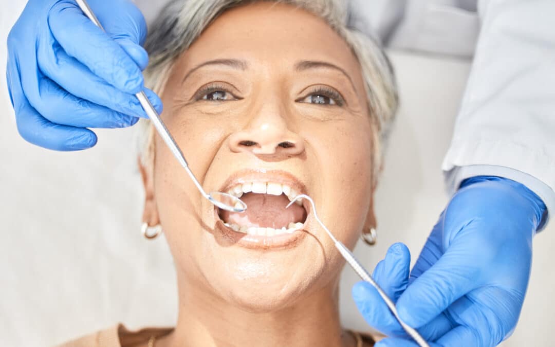 What Happens If You Skip the Dentist for a Year?